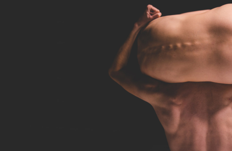 תבנית:סדק // 17 במרץ